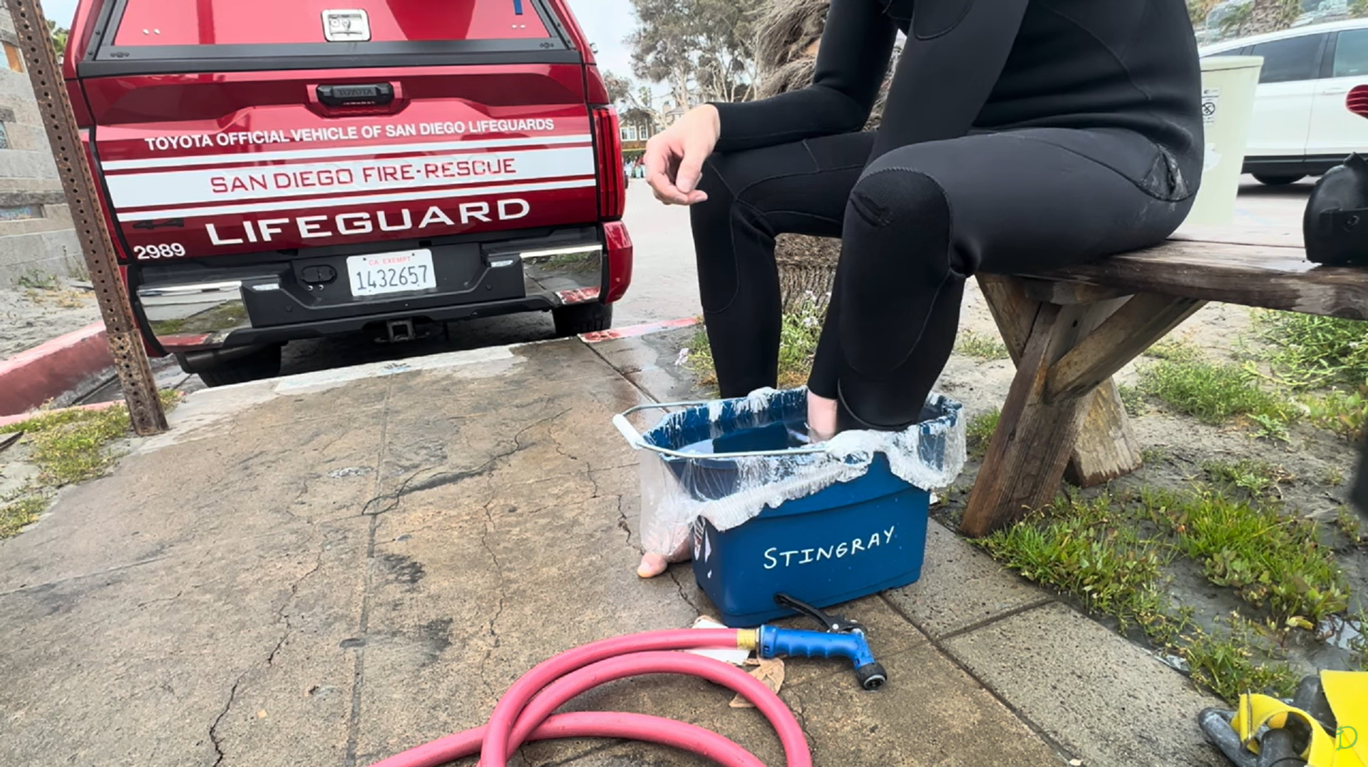 How to Treat a Stingray Sting